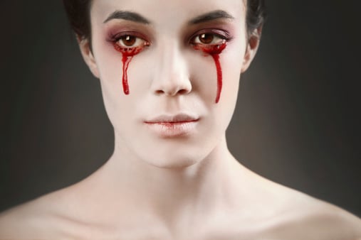 This rare condition can cause you to shed bloody tears