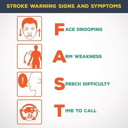 stroke symptoms face