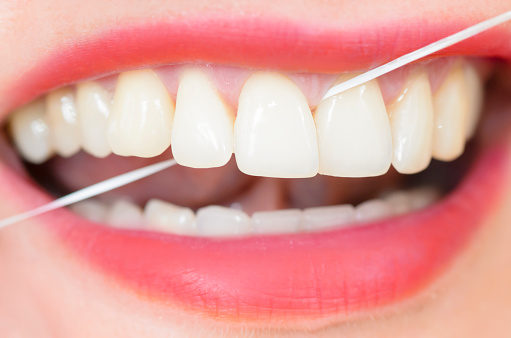 Bandit Sydamerika guld How Often Do You Floss Your Teeth ? - Health Beat