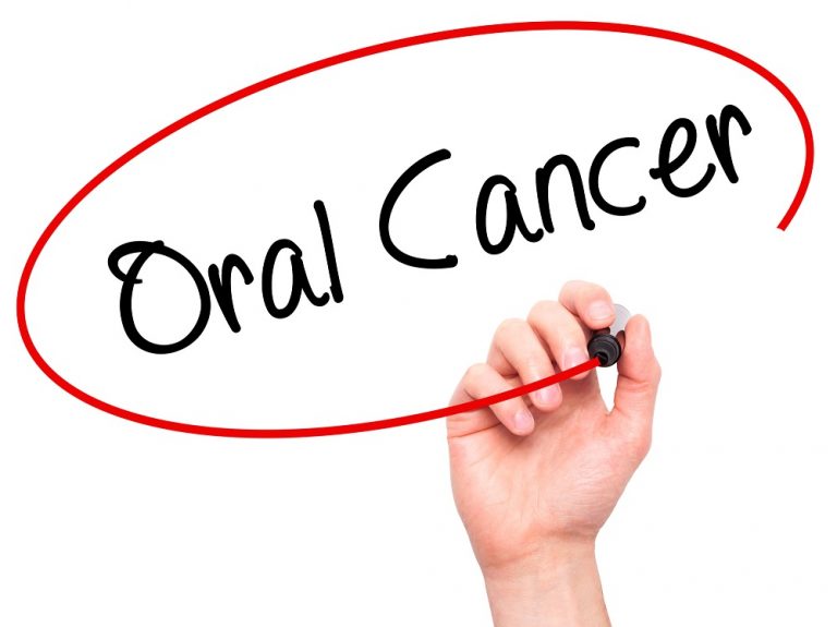 Oral Cancer Awareness Month Health Beat 