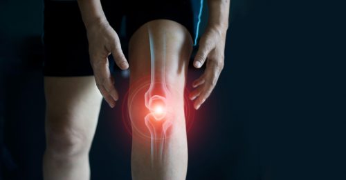 BURSITIS - Health Beat