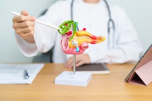 Doctor with human Pancreatitis anatomy model with Pancreas, Gallbladder, Bile Duct, Duodenum, Small intestine and tablet. Pancreatic cancer, acute pancreatitis and Digestive system