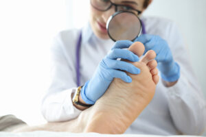 Dermatologist examining toenail with magnifying glass closeup. Diagnosis and treatment of fungal nail infections